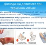 Домедична допомога при термічних опіках